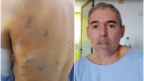 Recibe 100 perdigones al ser confundido con un conejo Recibe 100 perdigones al ser confundido con un conejo