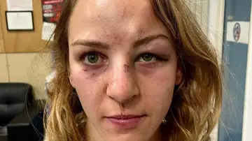 Margaux Pinot, campeona olímpica de judo, denuncia la agresión de su novio y entrenador: "¿Qué ha faltado, la muerte?" Margaux Pinot, campeona olímpica de judo, denuncia la agresión de su novio y entrenador: "¿Qué ha faltado, la muerte?"