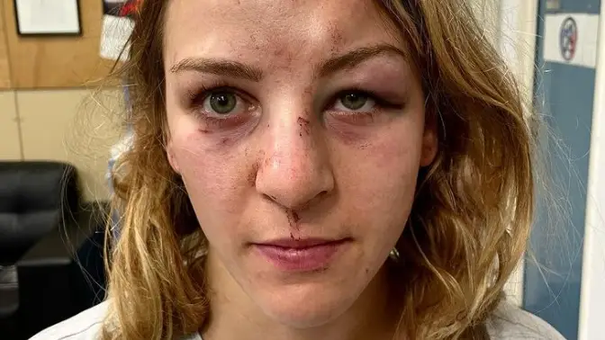 Margaux Pinot, campeona olímpica de judo, denuncia la agresión de su novio y entrenador: "¿Qué ha faltado, la muerte?" Margaux Pinot, campeona olímpica de judo, denuncia la agresión de su novio y entrenador: "¿Qué ha faltado, la muerte?"