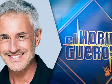 Sergio Dalma Sergio Dalma