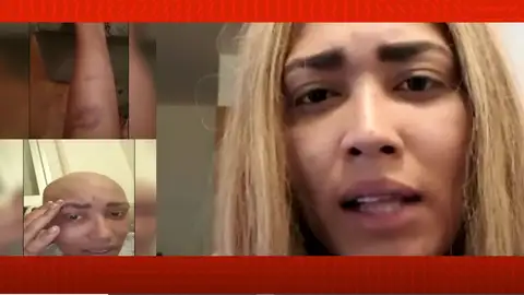 Agresión en una discoteca de Pamplona. Agresión en una discoteca de Pamplona.