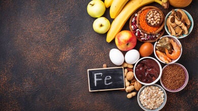 ¿Cómo puedo prevenir la anemia mediante la alimentación?