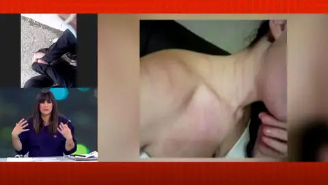 Una joven denuncia agresiones. Una joven denuncia agresiones.