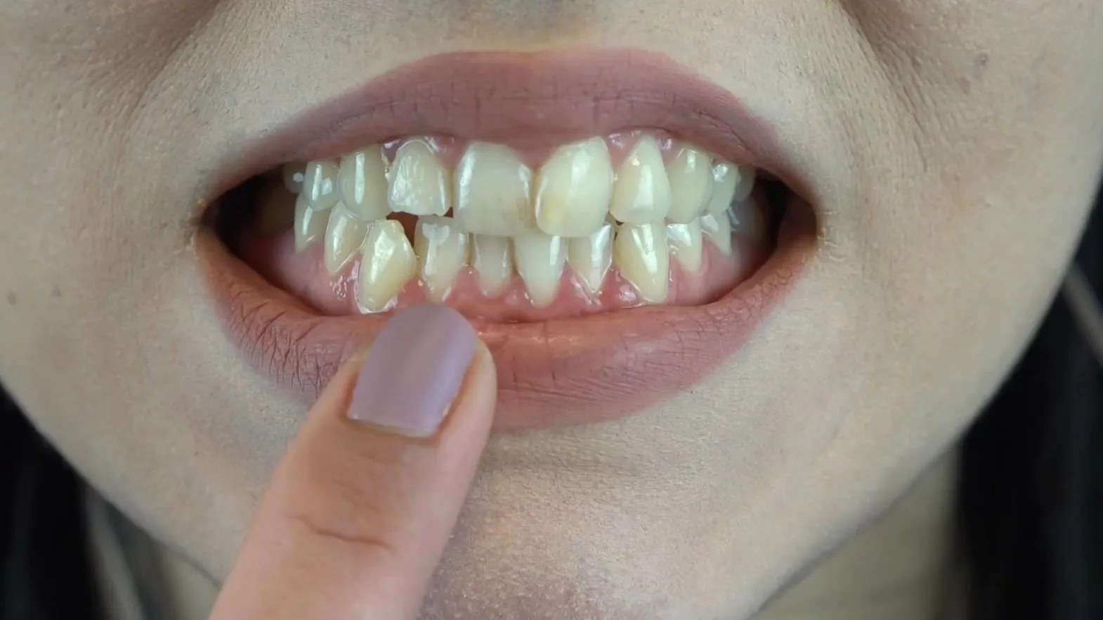 Cuidado de los dientes