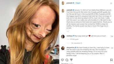 Muere Adalia Rose, la joven youtuber que padecía la enfermedad de 'Benjamin Button' e inspiró a millones de personas