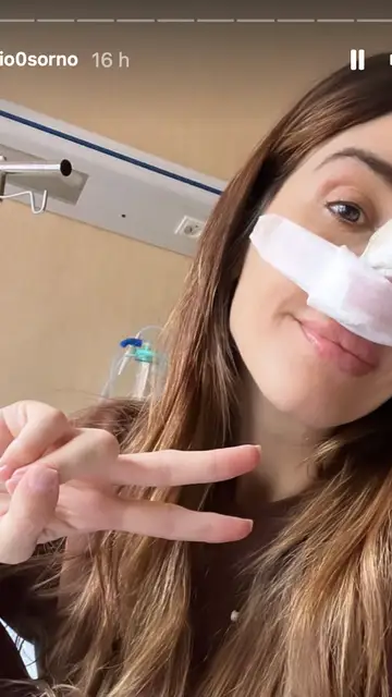 Rocio Osorno tras la rinoplastia Rocio Osorno