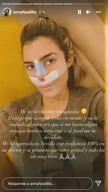 Anna Ferrer cuenta que se ha sometido a una rinoplastia Anna Ferrer cuenta que se ha sometido a una rinoplastia