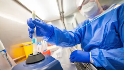 La subvariante BA.2 de ómicron llega a Baleares La subvariante BA.2 de ómicron llega a Baleares