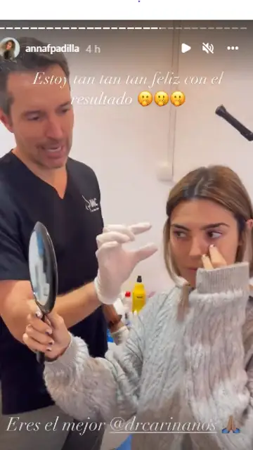 Anna Ferrer Padilla observando su nueva nariz Anna Ferrer Padilla observando su nueva nariz