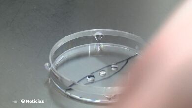 Un ginecólogo usó su propio esperma para tratamientos de fertilidad y ahora tendría al menos 21 descendientes