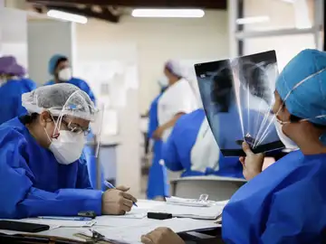 ¿Qué es la costocondritis, un efecto secundario poco conocido del coronavirus? ¿Qué es la costocondritis, un efecto secundario poco conocido del coronavirus?
