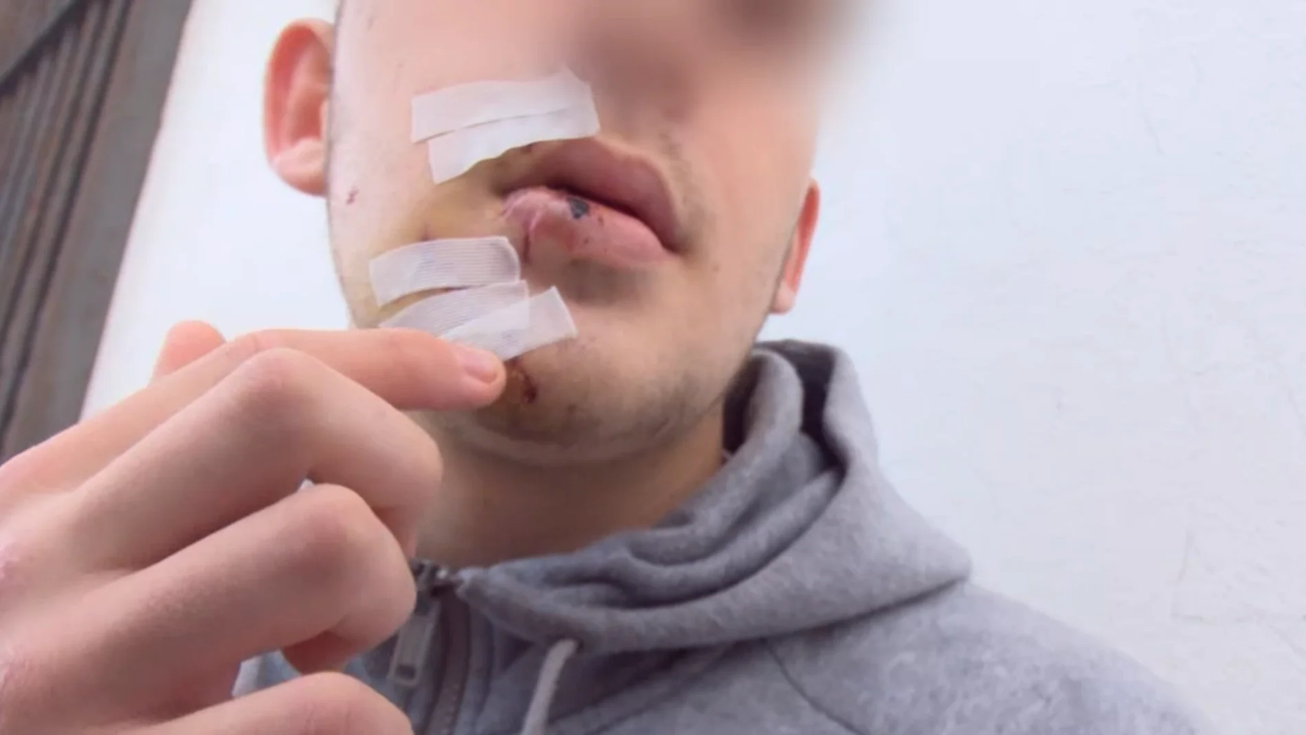 Un joven pide colaboración ciudadana para encontrar a los agresores que le golpearon con un vaso en la cara