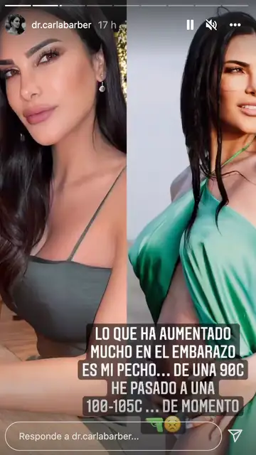 Carla Barber explica lo mucho que le ha aumentado el pecho durante el embarazo Carla Barber explica lo mucho que le ha aumentado el pecho durante el embarazo