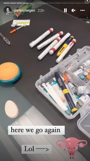 Chrissy Teigen Chrissy Teigen