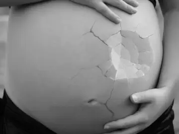 Imagen que representa al aborto Imagen que representa al aborto