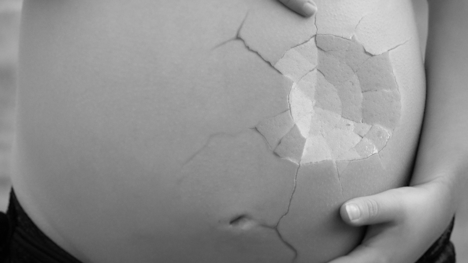 Imagen que representa al aborto Imagen que representa al aborto