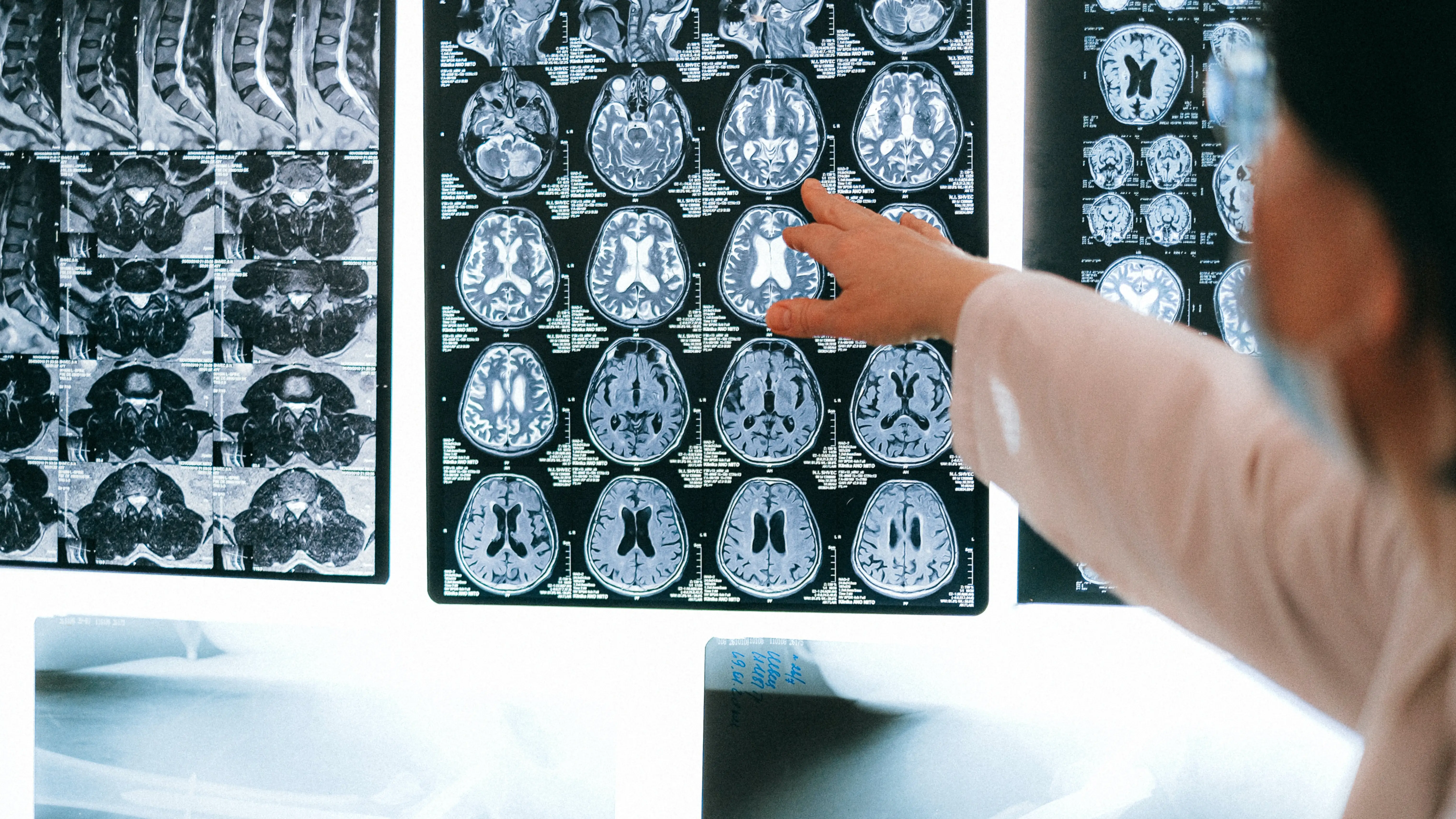 Un estudio revela que realmente la vida pasa ante nuestros ojos antes de morir Un estudio revela que realmente la vida pasa ante nuestros ojos antes de morir