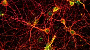 Neuronas Neuronas