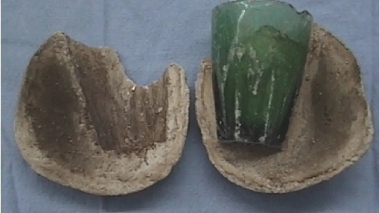 Y el cálculo y el vaso extraídos Y el cálculo y el vaso extraídos