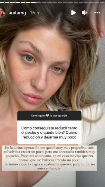 Ana Matamoros habla de su reducción de pecho
