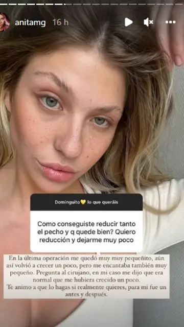 Ana Matamoros habla de su reducción de pecho Ana Matamoros habla de su reducción de pecho