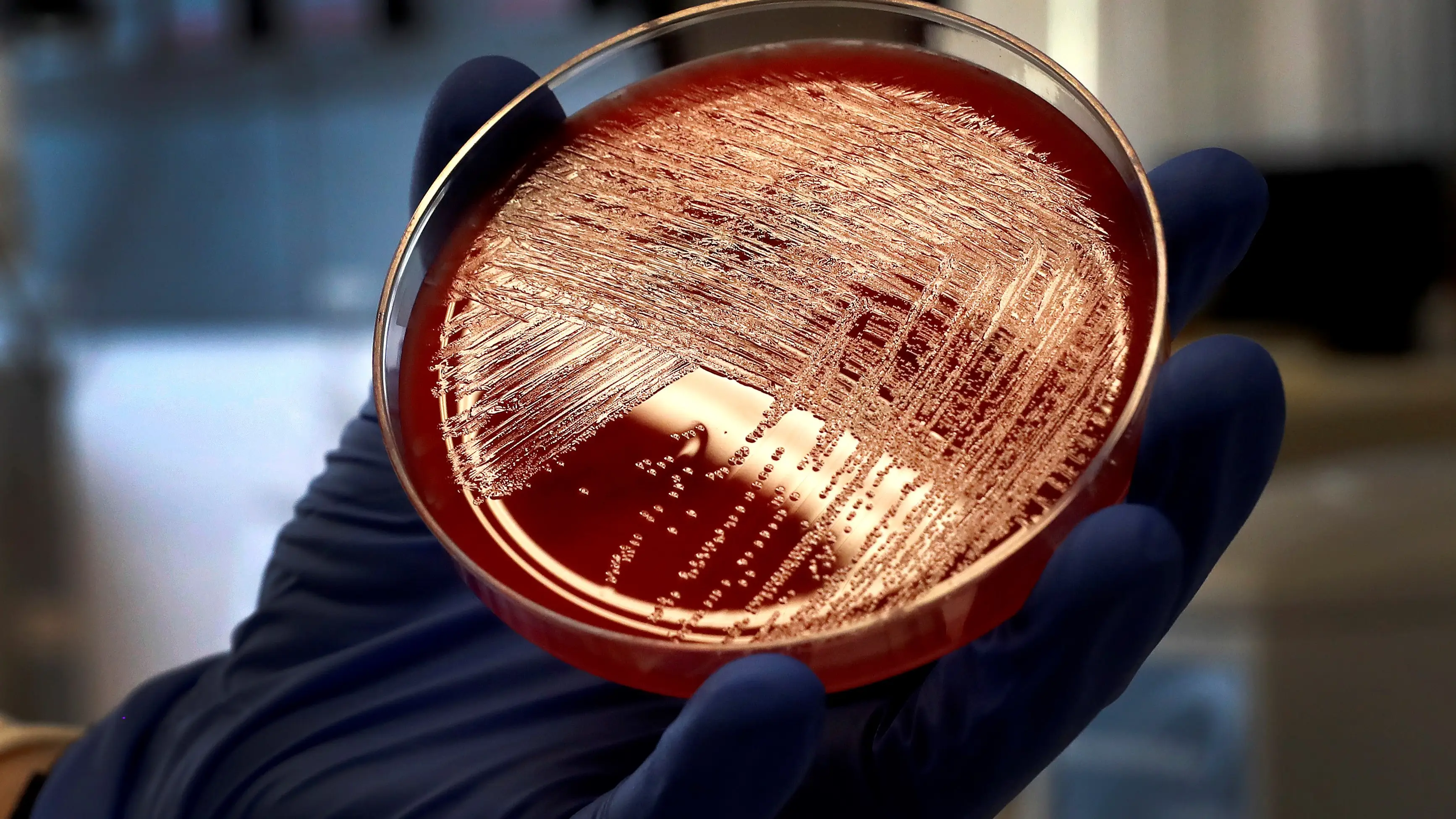 Alerta sanitaria por la presencia de listeria en un lote de embutidos fabricados en Espa&ntilde;a