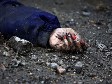 La foto que permitió reconocer a una víctima de la matanza de Bucha por su manicura