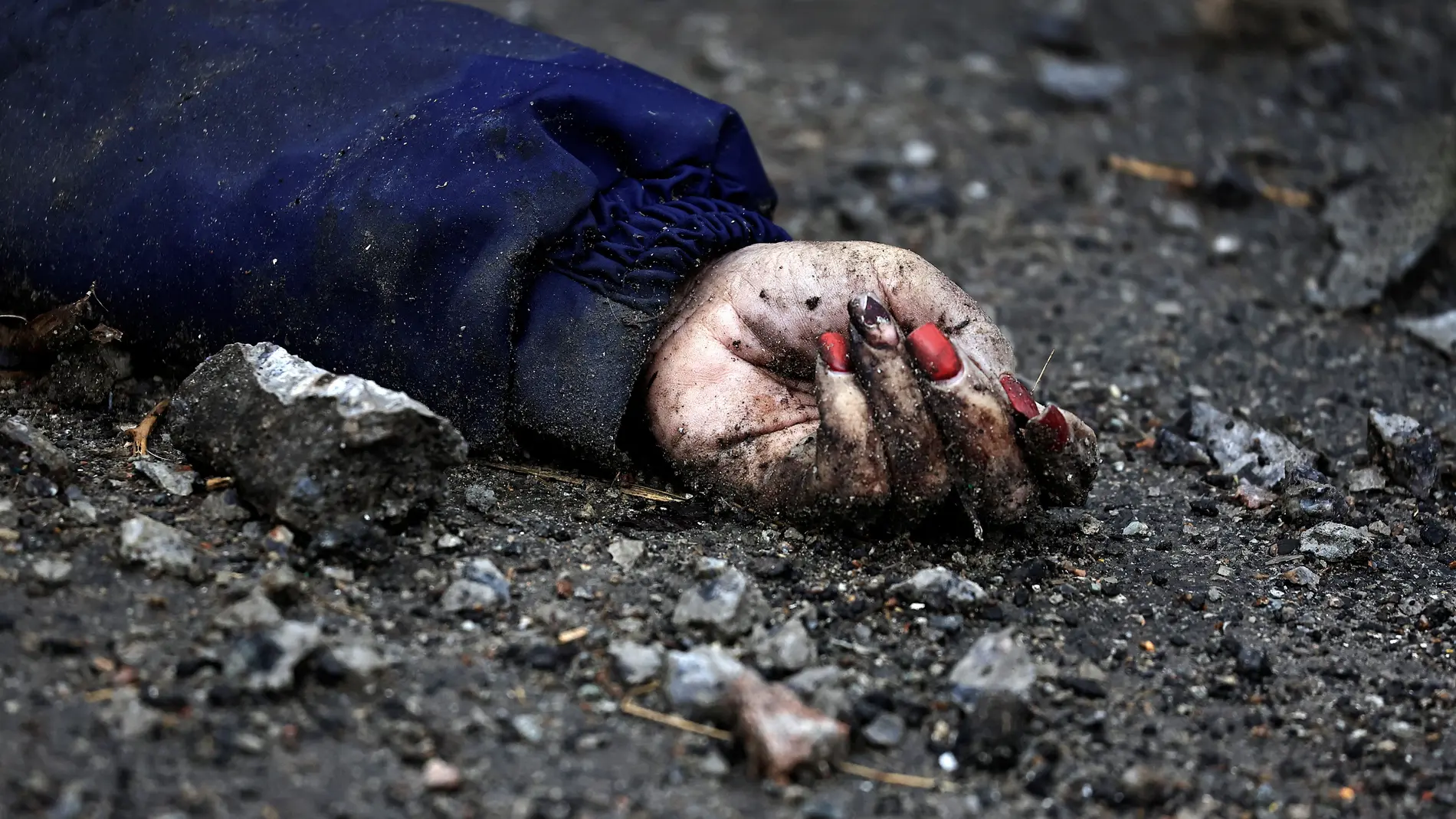La foto que permitió reconocer a una víctima de la matanza de Bucha por su manicura