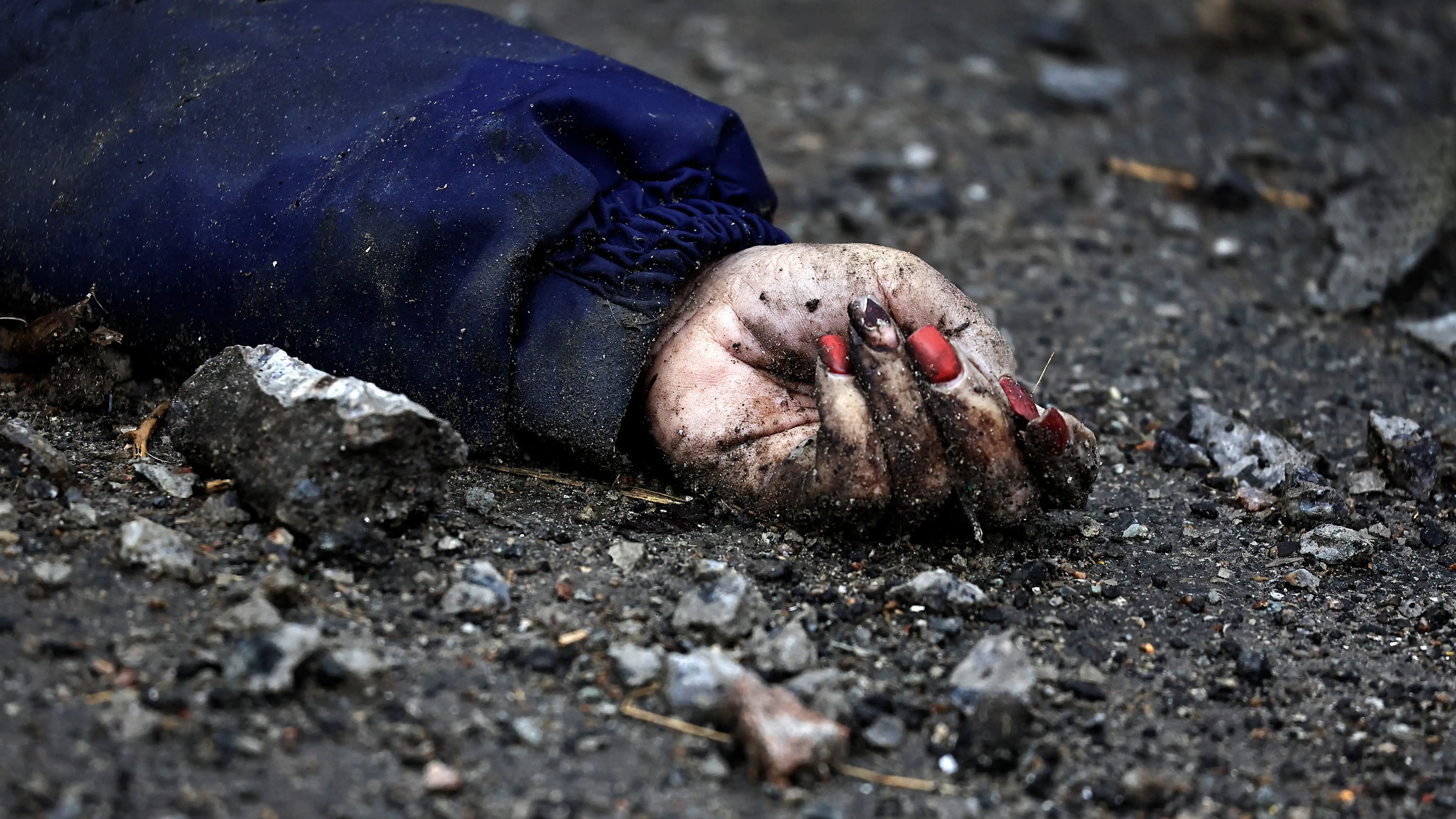 La foto que permitió reconocer a una víctima de la matanza de Bucha por su manicura La foto que permitió reconocer a una víctima de la matanza de Bucha por su manicura