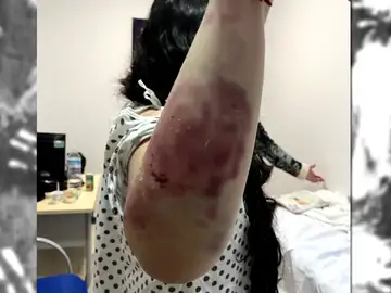 El joven que dio una brutal paliza a su novia de 17 años en Jerez ingresa en prisión tras entregarse