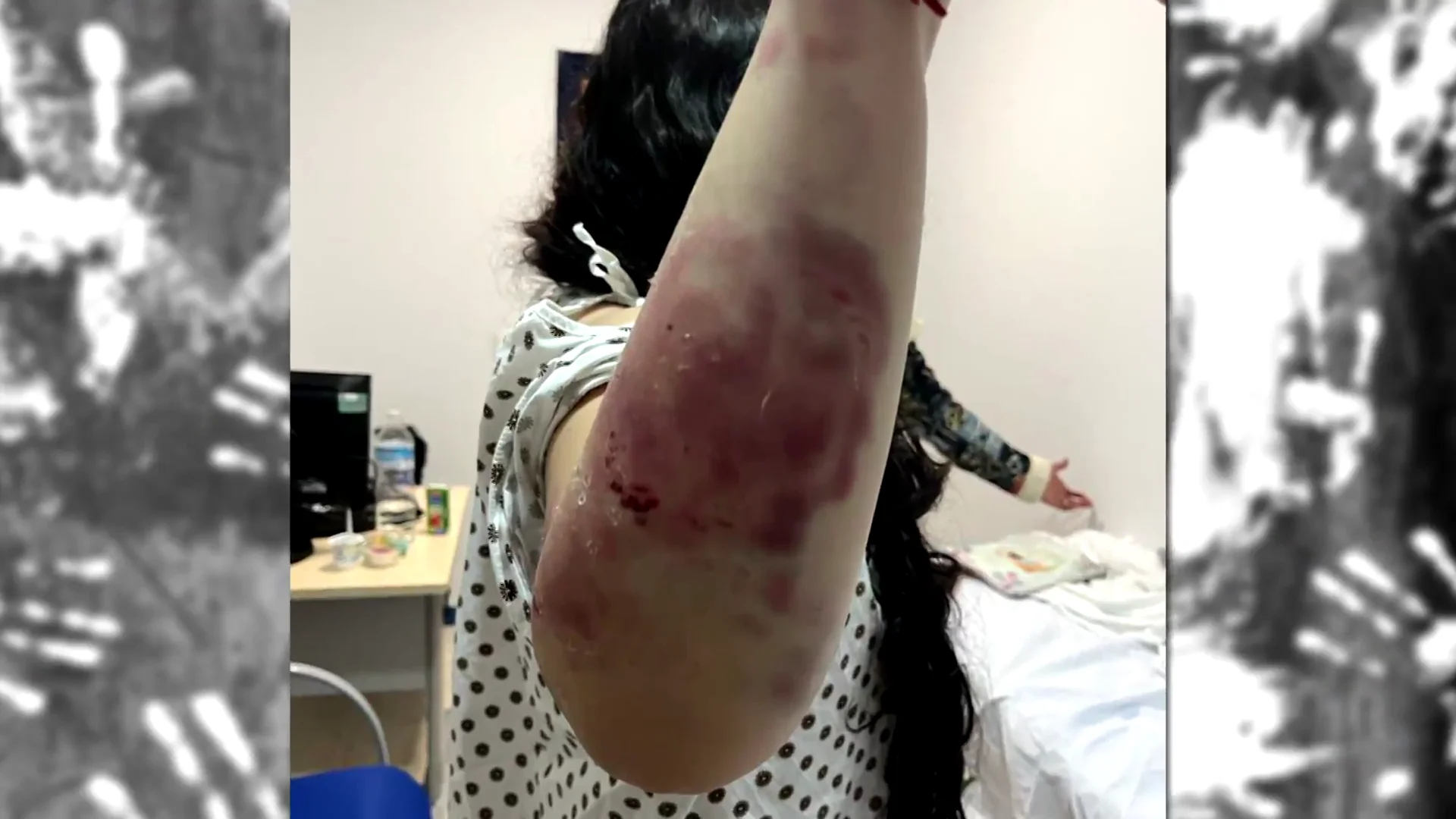 El joven que dio una brutal paliza a su novia de 17 años en Jerez ingresa en prisión tras entregarse "Si me ha hecho esto estando bien, quizá a la siguiente me mata"