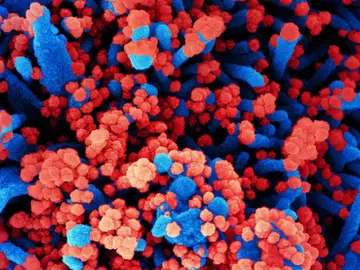 ¿Es el adenovirus F41 el causante de los casos de hepatitis aguda infantil? Estas son las hipótesis de la OMS ¿Es el adenovirus F41 el causante de los casos de hepatitis aguda infantil? Estas son las hipótesis de la OMS