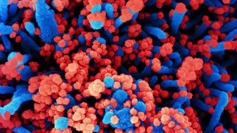 ¿Es el adenovirus F41 el causante de los casos de hepatitis aguda infantil? Estas son las hipótesis de la OMS ¿Es el adenovirus F41 el causante de los casos de hepatitis aguda infantil? Estas son las hipótesis de la OMS