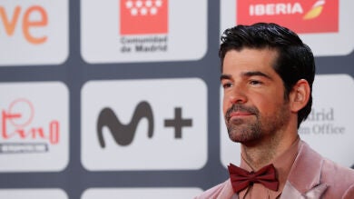 Miguel Ángel Muñoz revela cuál es el motivo de su llamativo tono de piel