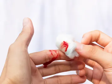 Dedo herido Dedo herido