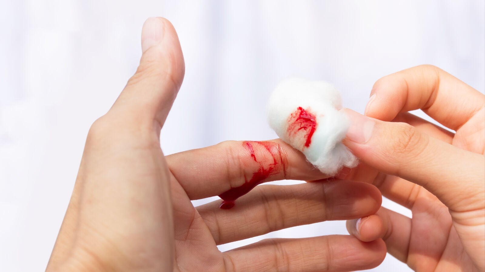 Dermatofagia: los riesgos de comernos nuestra propia piel 