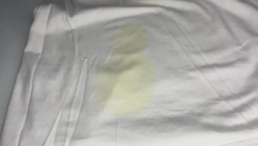 Cómo eliminar las manchas amarillas de la ropa blanca
