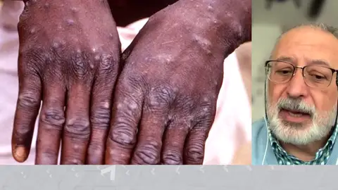 Daniel López Acuña Daniel López Acuña