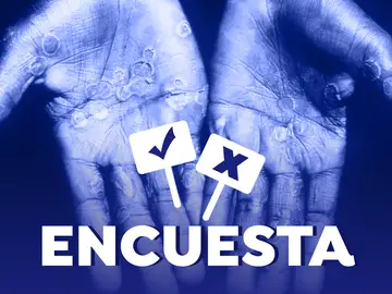 Participa en nuestra encuesta: ¿Crees que la viruela del mono tendrá una transmisión masiva en España? Participa en nuestra encuesta: ¿Crees que la viruela del mono tendrá una transmisión masiva en España?
