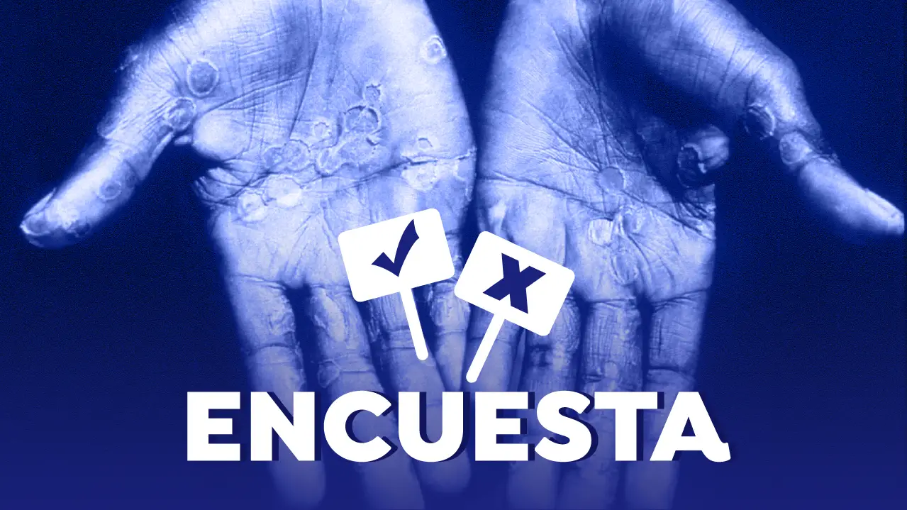 Participa en nuestra encuesta: &iquest;Crees que la viruela del mono tendr&aacute; una transmisi&oacute;n masiva en Espa&ntilde;a?