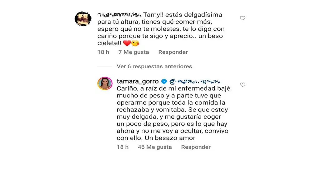 La respuesta de Tamara Gorro a una seguidora tras cuestionar su delgadez