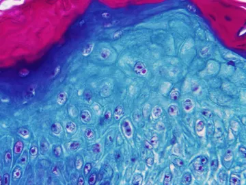 El Instituto de Salud Carlos III obtiene el genoma del virus del mono El Instituto de Salud Carlos III obtiene el genoma del virus del mono