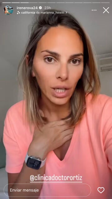 Irene Rosales muestra sus nuevos retoques estéticos