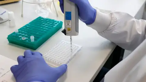 Sanidad pide evitar el contacto con mascotas a los contagiados de viruela del mono Sanidad pide evitar el contacto con mascotas a los contagiados de viruela del mono