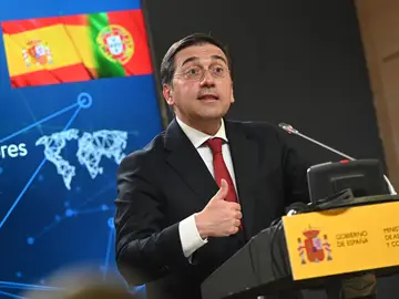 Albares se pronuncia sobre Argelia: "Somos pueblos amigos pero también libres" Albares se pronuncia sobre Argelia: "Somos pueblos amigos pero también libres"