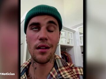 Justin Bieber anuncia que tiene una parálisis facial que le obliga a cancelar los próximos conciertos