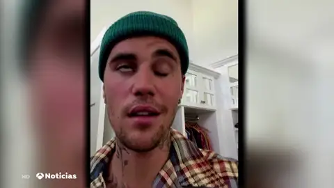 Justin Bieber anuncia que tiene una parálisis facial que le obliga a cancelar los próximos conciertos Justin Bieber anuncia que tiene una parálisis facial que le obliga a cancelar los próximos conciertos