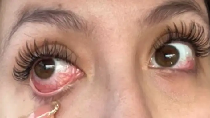 La historia viral de la joven que se puso pestañas postizas La historia viral de la joven que se puso pestañas postizas