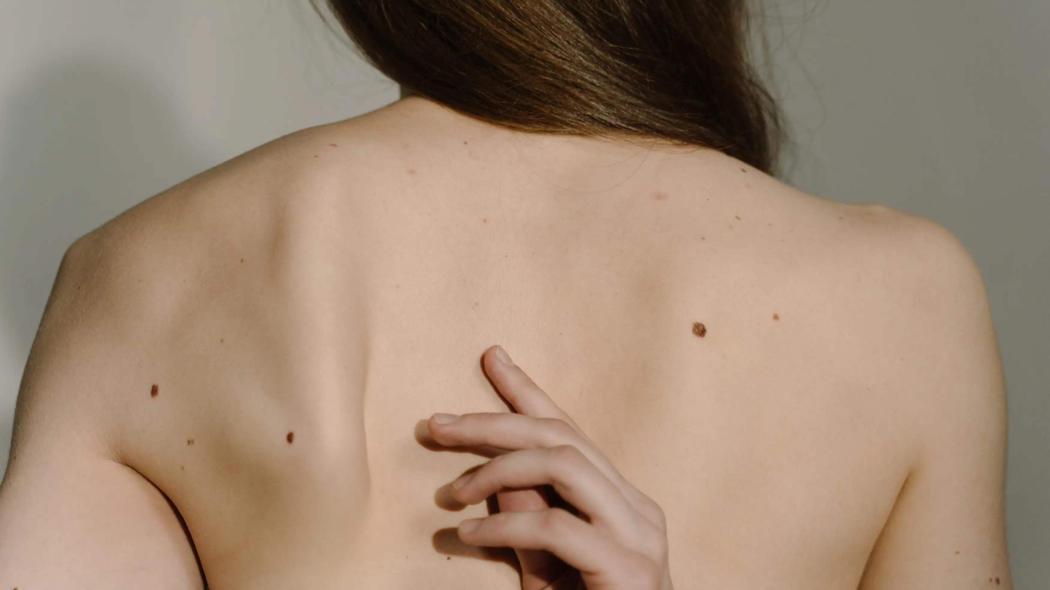 Chica con lunares Chica con lunares