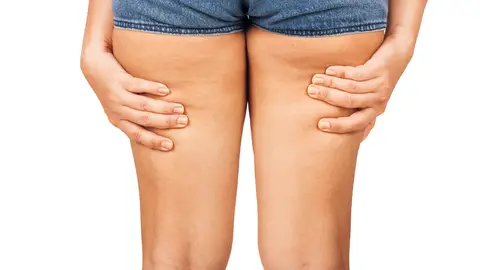 Roce de muslos Roce de muslos